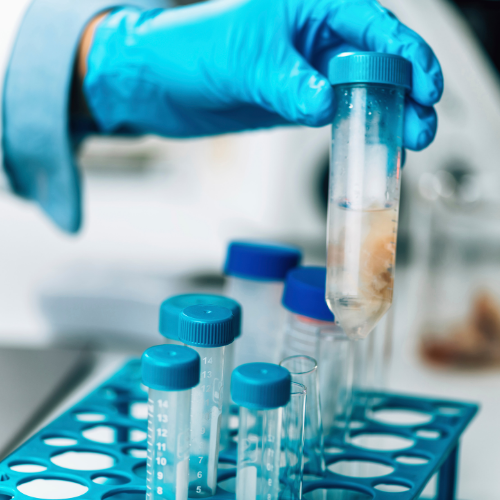 Laboratory Quality Control Kits