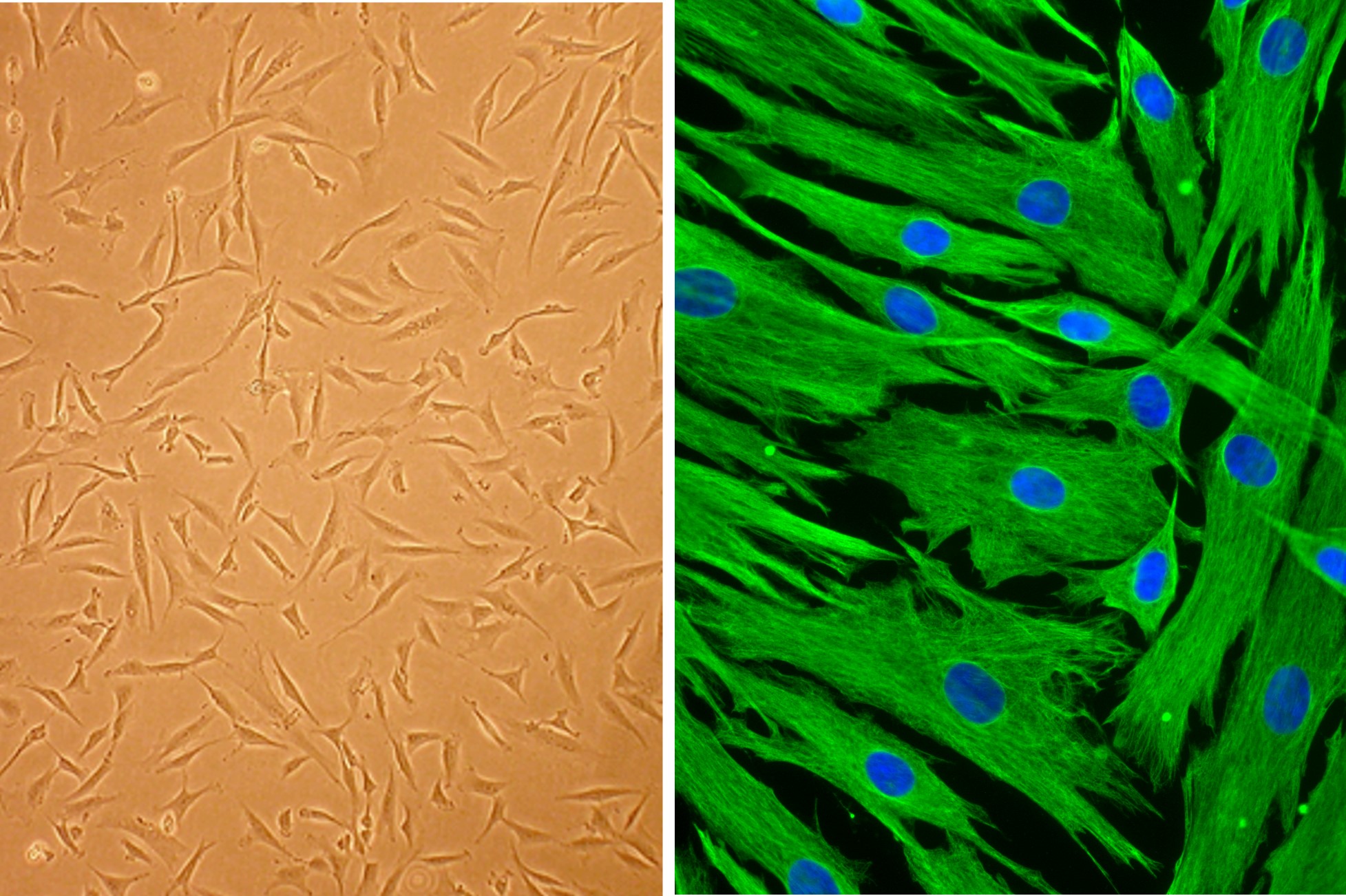 HFDPC | Primary Hair Follicle Dermal Papilla Cells | Human | Life ...