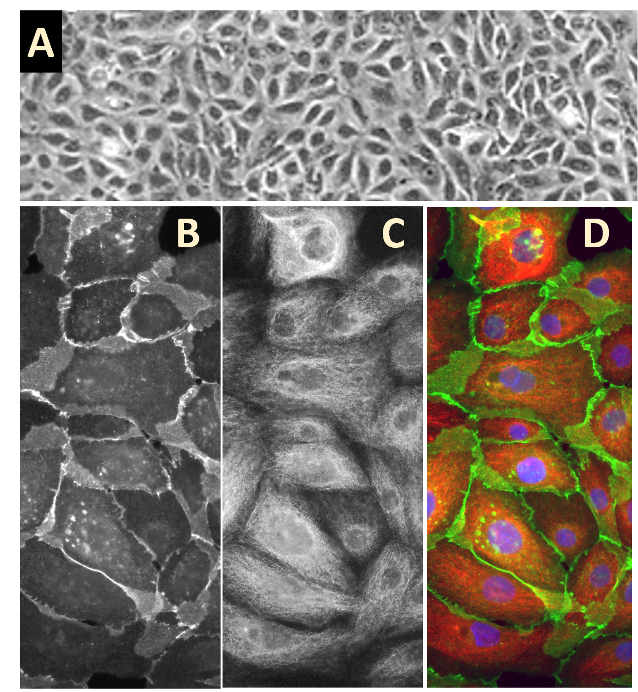 HMEpC | Primary Human Mammary Epithelial Cells | Life Technologies ...