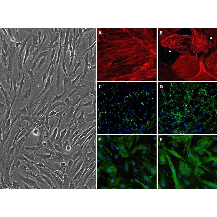 HTMC | Human Trabecular Meshwork Cells | Life Technologies (India) Pvt ...