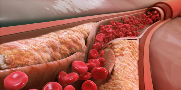 Lipoproteins & Small Molecules
